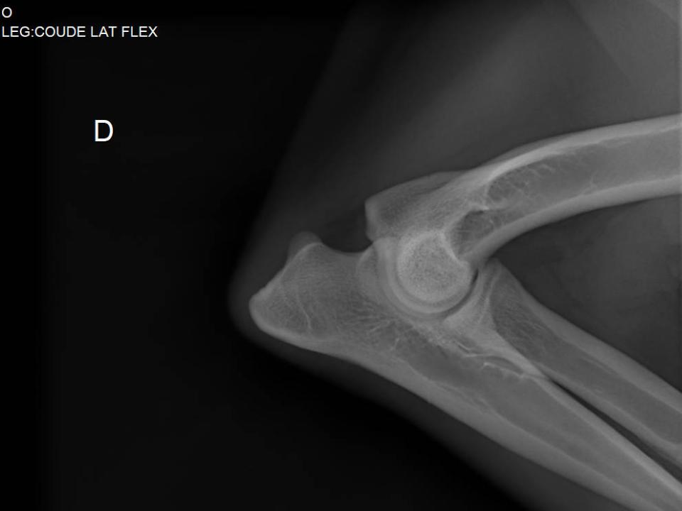 Radiographie Ollie suivi arthrose antérieur droit Gatavet 09/2025